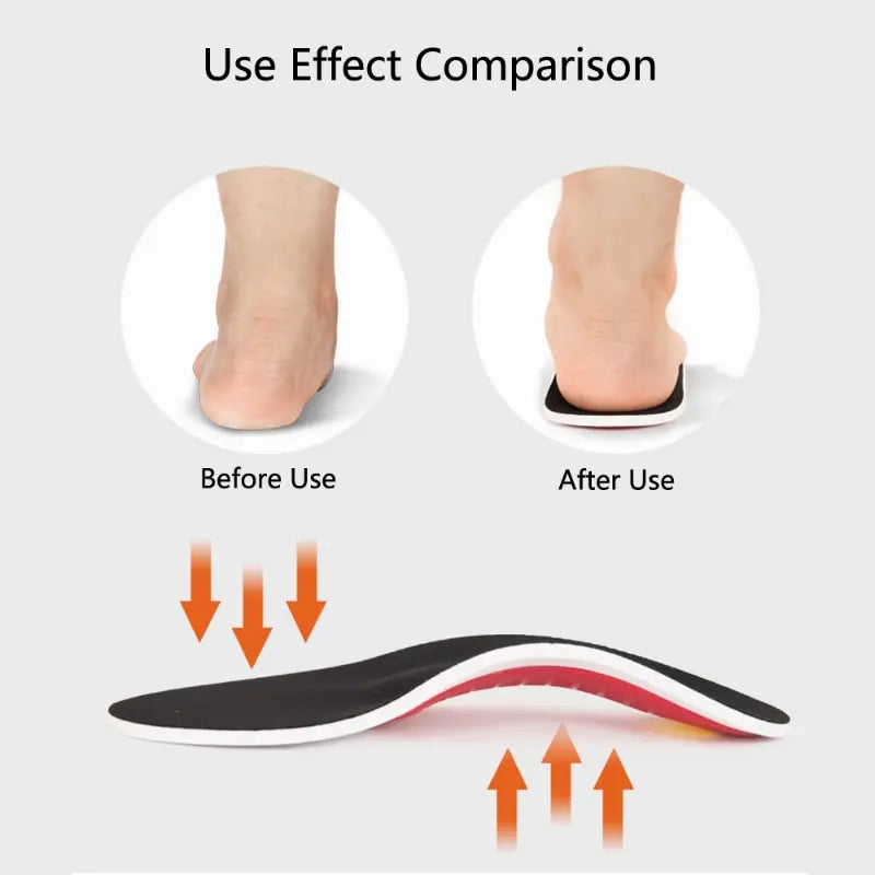 EVA Orthopedic Shoes Insoles Orthotic Flat Foot Arch